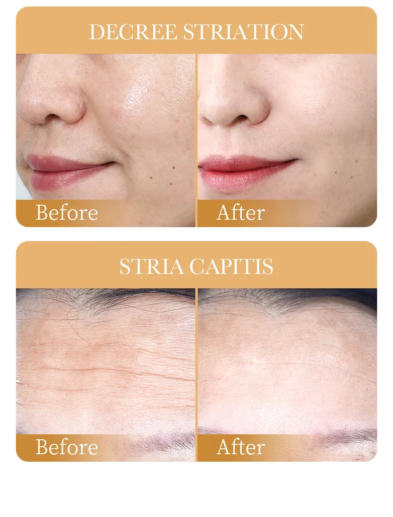 10pcs Anti-wrinkle Collagen Face Mask Moisturizing Anti-aging Repair Brightening skincare Face Sheet Mask Facial Masks Skin Care